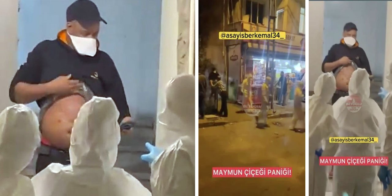 Maymun çiçeği virüsü İstanbul’a kadar geldi