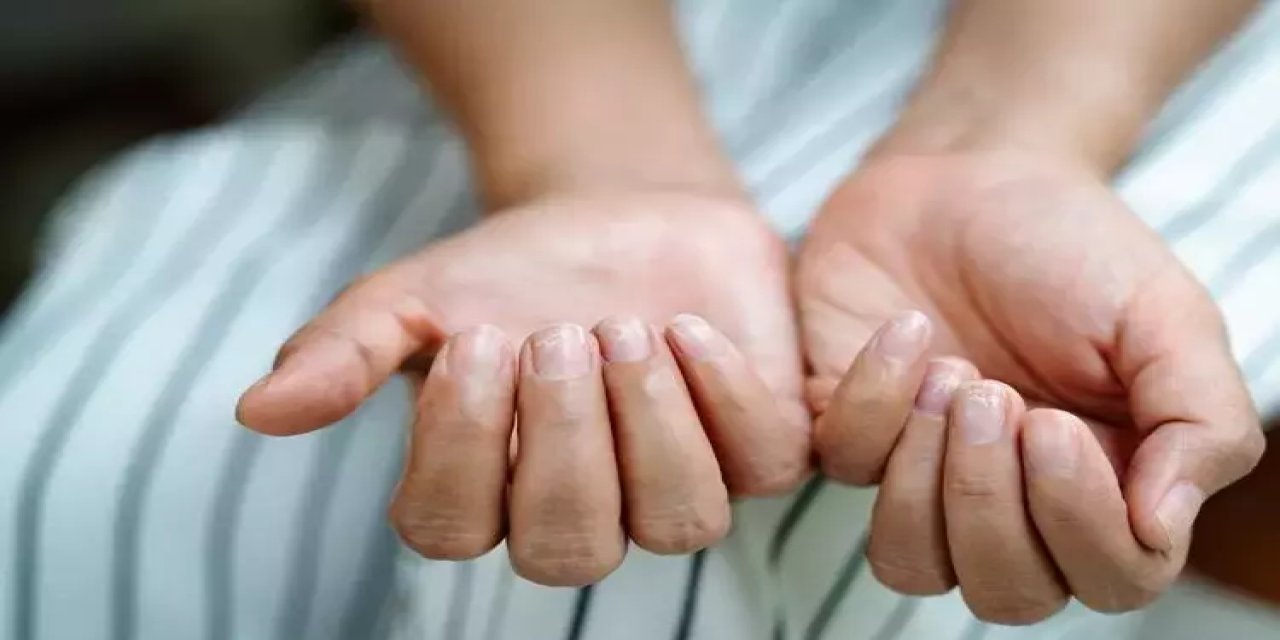 Tırnaktaki çizgiler hastalık sinyali olabilir