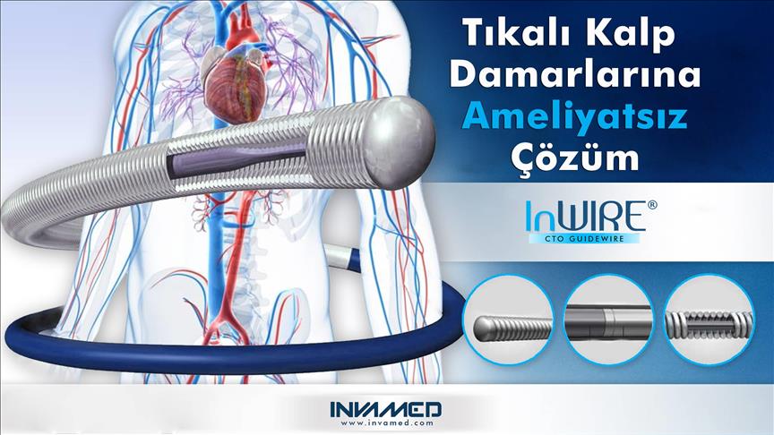 Tam tıkalı kalp damarlarına ameliyatsız çözüm